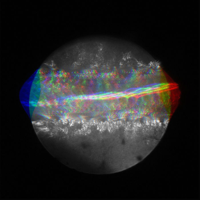 DORA SIAFLA (Greece) - UNDER THE MICROSCOPE